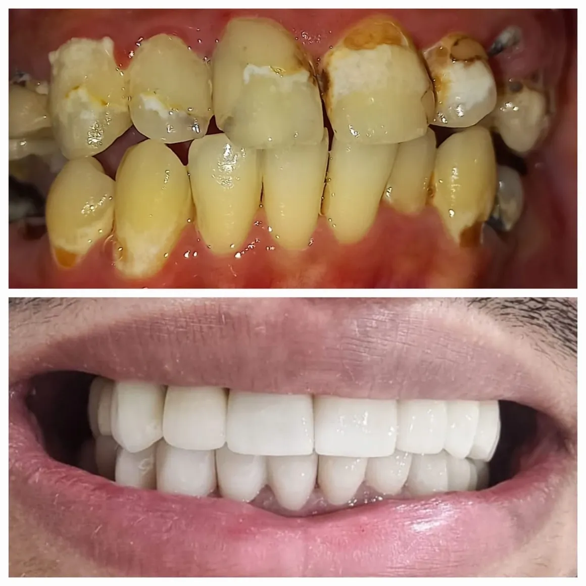 teeth1