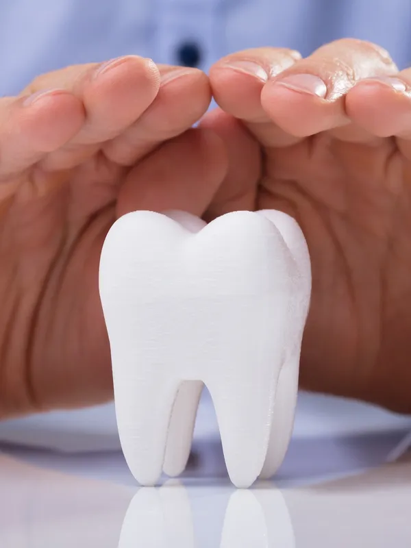 Root Canal Treatment (RCT)