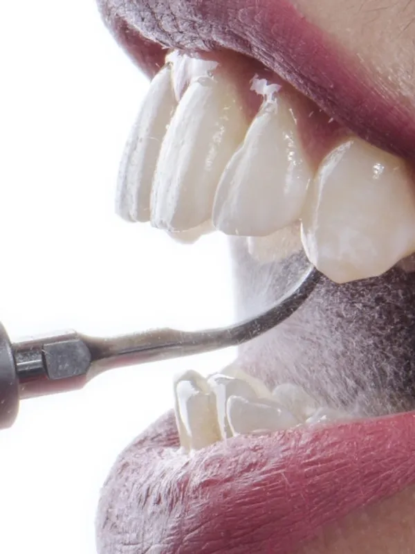 Routine Dental Visits