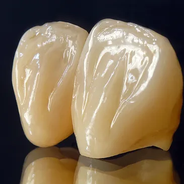 Zirconia Crowns