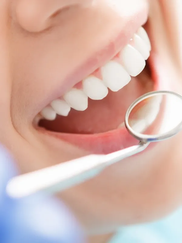 dental consultation at AA dental studio