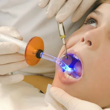 dental filling